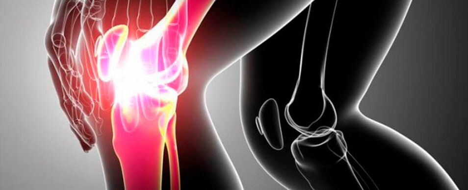 dolor en la articulación de la rodilla foto 4